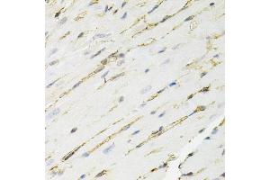 Immunohistochemistry of paraffin-embedded mouse heart using ANXA2 antibody. (Annexin A2 anticorps)