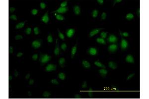 Immunofluorescence of monoclonal antibody to TOE1 on HeLa cell. (TOE1 anticorps  (AA 1-510))