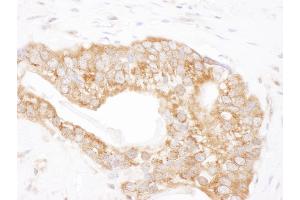 Immunohistochemistry (IHC) image for anti-T-Complex 1 (TCP1) (AA 450-500) antibody (ABIN7454916)