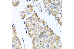 Immunohistochemistry of paraffin-embedded human gastric using GLS antibody at dilution of 1:100 (x40 lens). (Glutaminase anticorps)