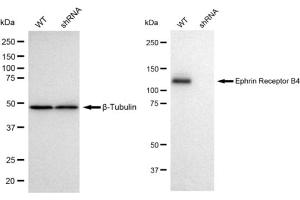 Western blotting analysis using Ephrin Receptor B4 antibody (ABIN7798459). (Recombinant Ephrin Receptor B4 anticorps)
