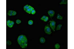 Immunofluorescent analysis of MCF-7 cells using ABIN7174356 at dilution of 1:100 and Alexa Fluor 488-congugated AffiniPure Goat Anti-Rabbit IgG(H+L)