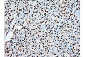 Immunohistochemical staining of paraffin-embedded Human colon tissue using anti-TACC3 mouse monoclonal antibody. (TACC3 anticorps)
