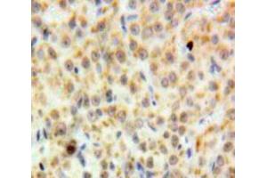 Used in DAB staining on fromalin fixed paraffin-embedded Ovary tissue (DDB2 anticorps  (AA 166-383))