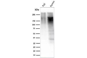 Western Blot Analysis of Raji and Ramos cell lysate using Ki67 Mouse Monoclonal Antibody (MKI67/2463). (Ki-67 anticorps  (AA 2293-2478))