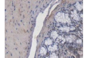 IHC-P analysis of Mouse Colon Tissue, with DAB staining. (Calcitonin Receptor anticorps  (AA 42-170))