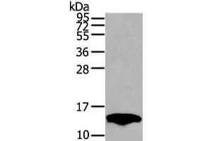 Western Blot analysis of Mouse fat tissue using PMP2 Polyclonal Antibody at dilution of 1/400 (PMP2 anticorps)