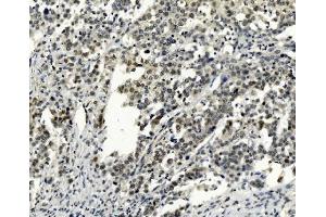 IHC analysis of SMAD2 using anti-SMAD2 antibody (ABIN7602542). (SMAD2 anticorps  (AA 83-264))