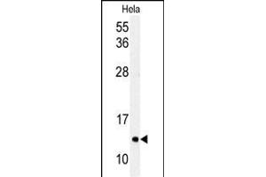 Western blot analysis of G8c (M1LC3C) Antibody (T48) 1804e in Hela cell line lysates (35 μg/lane). (MAP1LC3A anticorps  (AA 27-57))