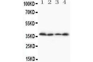 Anti-Stra8 antibody, Western blotting Lane 1: A231 Cell Lysate Lane 2: JURKAT Cell Lysate Lane 3:  Cell Lysate Lane 4: SCG Cell Lysate (STRA8 anticorps  (C-Term))