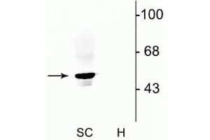 Western blot of rat spinal cord lysate (SC) showing specific immunolabeling of the ~48 kDa α1- and α2-subunits of the glycine receptor. (GLRA1 anticorps  (N-Term))