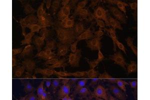 Immunofluorescence analysis of C6 cells using BID Polyclonal Antibody at dilution of 1:100. (BID anticorps)