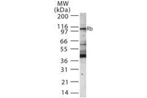 Western Blotting (WB) image for anti-Retinoblastoma Protein (Rb Protein) (AA 251-268) antibody (ABIN233206) (Retinoblastoma Protein (Rb) anticorps  (AA 251-268))