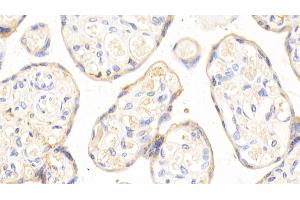 Detection of APOH in Human Placenta Tissue using Polyclonal Antibody to Apolipoprotein H (APOH)