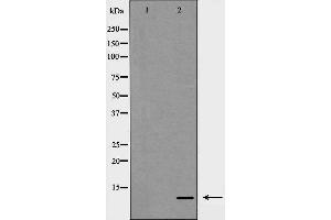 Western blot analysis of S100 A10 expression in COLO cells,The lane on the left is treated with the antigen-specific peptide. (S100A10 anticorps  (Internal Region))