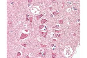 Anti-TSG / TWSG1 antibody IHC staining of human brain, cortex. (TWSG1 anticorps  (AA 1-223))