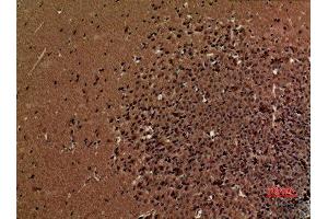 Immunohistochemistry (IHC) analysis of paraffin-embedded Mouse Brain, antibody was diluted at 1:100. (CAMK2D anticorps  (Internal Region))