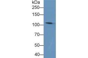 Detection of C5a in Rat Plasma using Polyclonal Antibody to Complement Component 5a (C5a) (C5A anticorps  (AA 679-755))