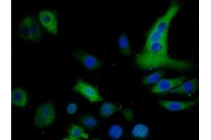 Detection of S100P in Human HepG2 cell using Polyclonal Antibody to S100 Calcium Binding Protein P (S100P)