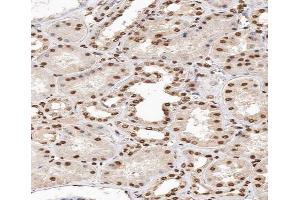 ABIN6267664 at 1/200 staining human kidney tissue sections by IHC-P. (MAPK14 anticorps  (pTyr182))