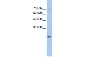 WB Suggested Anti-GSTM1 Antibody Titration:  0. (GSTM1 anticorps  (N-Term))