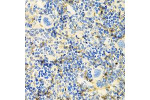 Immunohistochemistry of paraffin-embedded mouse spleen using ICOS antibody (ABIN5970917) at dilution of 1/100 (40x lens). (ICOS anticorps)