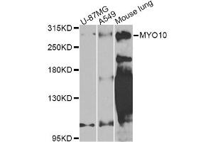 Western blot analysis of extracts of various cell lines, using MYO10 Antibody (ABIN5974593) at 1/1000 dilution. (Myosin X anticorps)