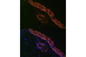 Immunofluorescence analysis of Mouse tail and ear using IL1RA Rabbit mAb (ABIN7267971) at dilution of 1:100 (40x lens).