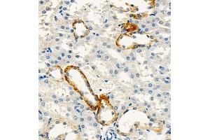 Immunohistochemistry of paraffin embedded mouse kidney using Cdcp1 (ABIN7073600) at dilution of 1:300 (400x lens) (CDCP1 anticorps)