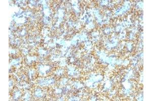 Formalin-fixed, paraffin-embedded human parathyroid stained with PTH antibody (PTH/1174). (PTH anticorps  (AA 32-115))