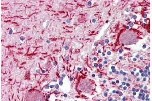Human Brain, Cerebellum (formalin-fixed, paraffin-embedded) stained with MEF2C antibody ABIN462315 followed by biotinylated goat anti-rabbit IgG secondary antibody ABIN481713, alkaline phosphatase-streptavidin and chromogen.