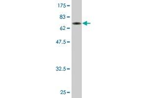 Western Blot detection against Immunogen (73. (TADA3L anticorps  (AA 1-432))
