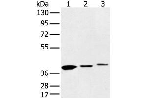 Western blot analysis of 231 cell Human fetal liver and Human fetal brain tissue using MAT2B Polyclonal Antibody at dilution of 1:500 (MAT2B anticorps)