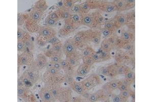 Used in DAB staining on fromalin fixed paraffin- embedded liver tissue (GCDH anticorps  (AA 270-438))