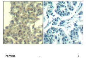 Image no. 1 for anti-Receptor Tyrosine-Protein Kinase ErbB-3 (ERBB3) (AA 1326-1330) antibody (ABIN319384) (ERBB3 anticorps  (AA 1326-1330))