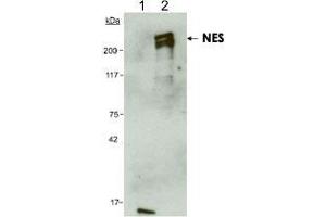 Detection of human NES using NES monoclonal antibody, clone 10C2 . (Nestin anticorps  (AA 1464-1614))