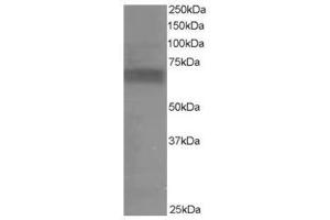 Image no. 1 for anti-Ribosomal Protein S6 Kinase, 70kDa, Polypeptide 1 (RPS6KB1) (C-Term) antibody (ABIN374267) (RPS6KB1 anticorps  (C-Term))
