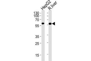 Western Blotting (WB) image for anti-Glucokinase (Hexokinase 4) (GCK) antibody (ABIN2930453)