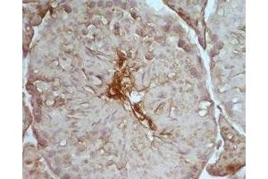 Mouse testis tissue was stained by Rabbit Anti-Desnutrin (465-486) (Mouse) Serum (PNPLA2 anticorps  (AA 465-486))