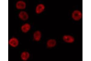 ABIN6275740 staining Hela by IF/ICC. (MNT anticorps  (Internal Region))