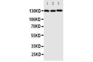Western Blotting (WB) image for anti-Cadherin 5 (CDH5) (AA 766-784), (C-Term) antibody (ABIN3042913) (Cadherin 5 anticorps  (C-Term))