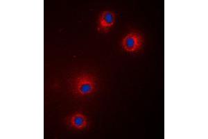 Immunofluorescent analysis of GPR18 staining in Jurkat cells. (GPR18 anticorps  (Center))