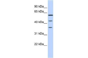WB Suggested Anti-PHF23 Antibody Titration:  0. (PHF23 anticorps  (N-Term))