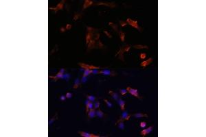 Immunofluorescence analysis of NIH/3T3 cells using  antibody (ABIN6133586, ABIN6137050, ABIN6137052 and ABIN6225252) at dilution of 1:100. (Aquaporin 5 anticorps  (AA 150-250))