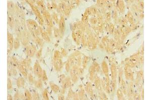 Immunohistochemistry of paraffin-embedded human heart tissue using ABIN7172320 at dilution of 1:100 (TP53TG5 anticorps  (AA 1-290))