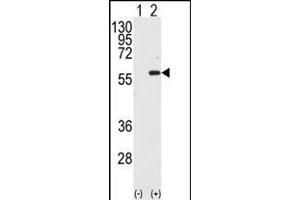 Western blot analysis of STK4 (arrow) using MST1 Antibody (C-term) (ABIN392427 and ABIN2842030). (MST1 anticorps  (C-Term))