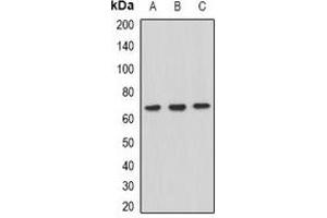 Western blot analysis of XPV expression in Hela (A), HepG2 (B), Raji (C) whole cell lysates. (POLH anticorps)