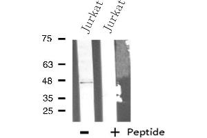 Western blot analysis of extracts from Jurkat cells using PLCH antibody. (AGPAT9 anticorps  (Internal Region))