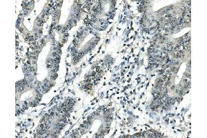 IHC analysis of ATF1 using anti-ATF1 antibody (ABIN7599192).