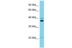 Host: Rabbit Target Name: OR5I1 Sample Type: Jurkat Whole Cell lysates Antibody Dilution: 1. (OR5I1 anticorps  (C-Term))